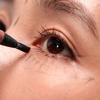Blefaroplastia
