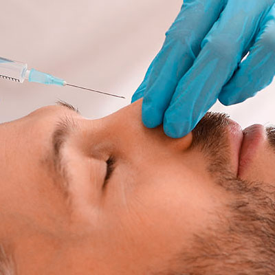 Rinoplastia