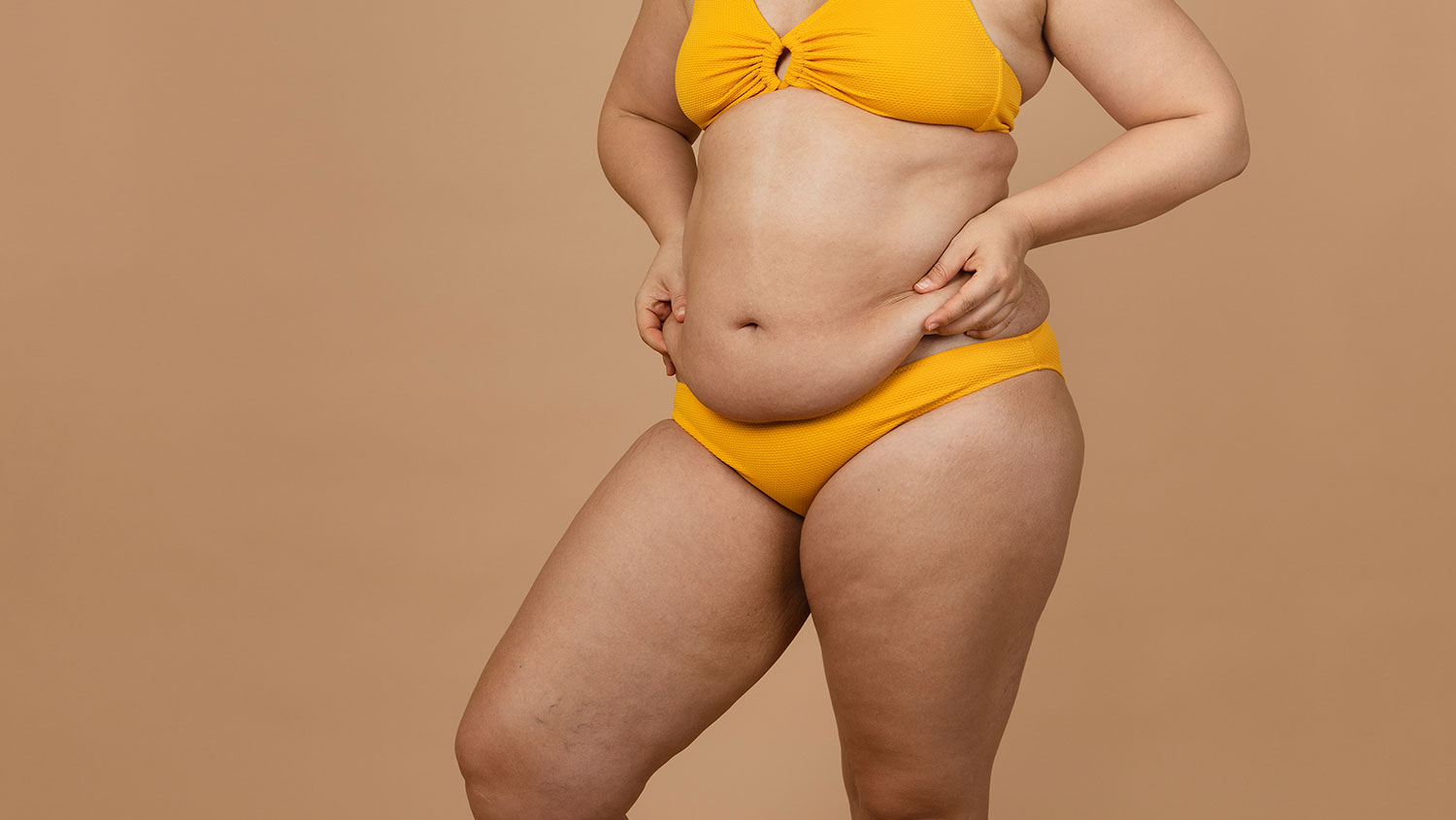 Abdominoplastia quito Abdominoplastia quito